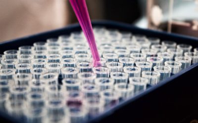 Promising new research identifying target involved in spread of Pancreatic Cancer
